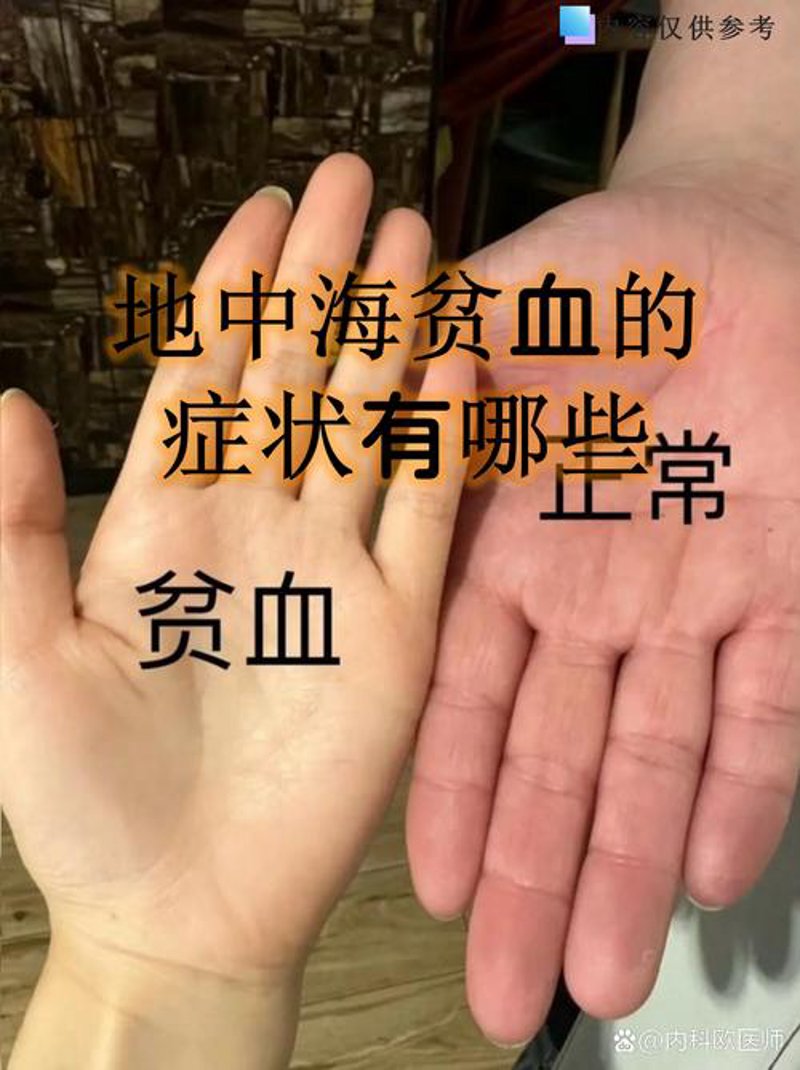 了解地中海贫血：常见问答与科普知识